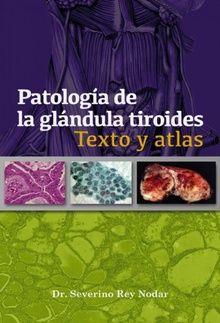 Patología de la glándula tiroides Texto y Atlas (Digital)