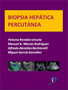 Biopsia hepática percutánea